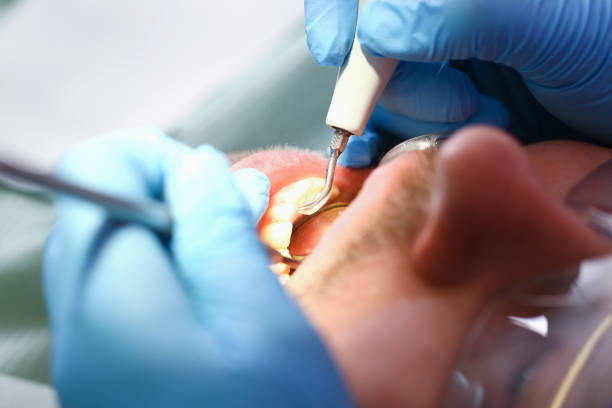 Best Emergency Tooth Extraction  in Manning, IA