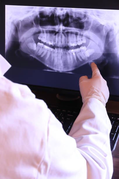 Best Dentist for Tooth Abscess  in Manning, IA