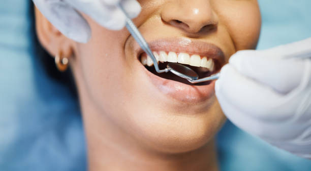 Best Chipped Tooth Repair Near Me  in Manning, IA