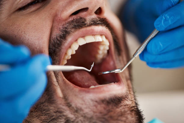 Best Knocked-Out Tooth Emergency  in Manning, IA